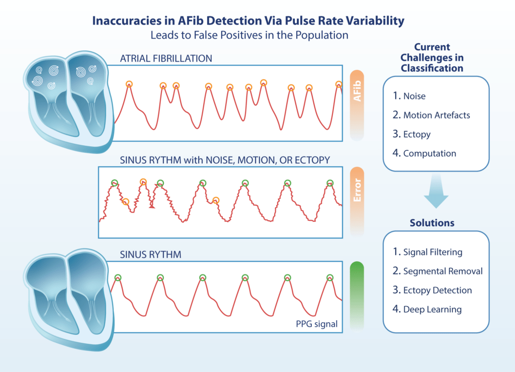 Weighing the Effectiveness of Photoplethysmography Signal Analysis in ...